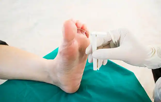 Beeld Diabetische screening